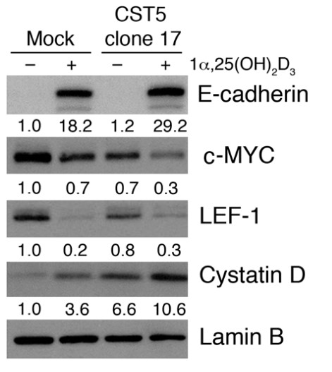 Western blot analysis showing changes in E-cadherin, c-MYC, and LEF-1 proteins in cystatin D–expressing cells.jpg